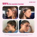 acne out активен лосион против пъпки